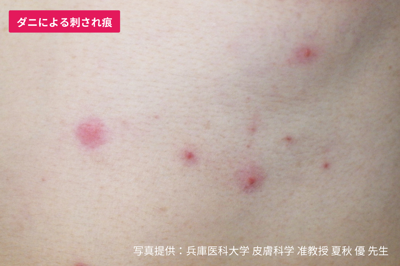 牛乳で洗顔できますか?