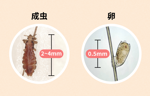 アタマジラミの成虫と卵の写真 全長2~4mm, 卵は0.5mm
