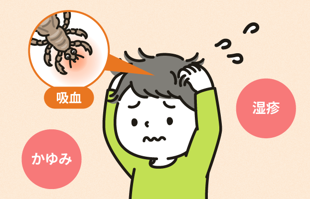 イメージ画像:アタマジラミに感染すると吸血された部分にかゆみや湿疹が発生する