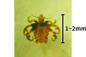ケジラミの写真 全長1〜2mm